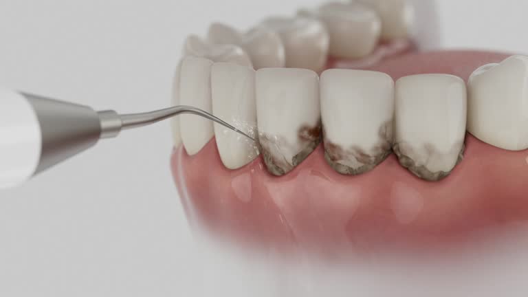 Reliable Dental Implants contractor in Redlands, CO by Smile Center Dentistry